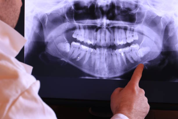Best Emergency Wisdom Teeth Removal in Mckeesport, PA